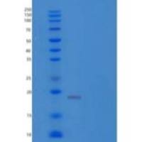 人t细胞受体相互作用分子/TRIM/TCRIM/TRAT1重组蛋白C-6His