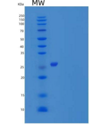 人Toll相互作用蛋白(TOLLIP)重组蛋白C-6His
