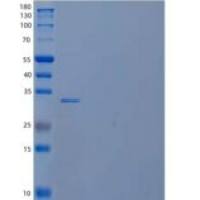 人磷酸甘露糖酶1(PMM1)重组蛋白C-6His