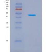 人白介素21(IL21)重组蛋白