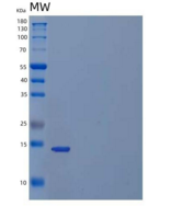 人抑制素βC(INHbC)重组蛋白N-6His