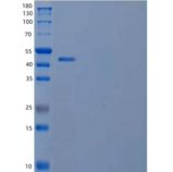 人泛素硫酯酶OTUB2/OTUB2重组蛋白N-GST