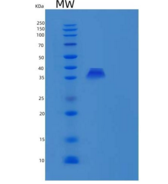 人PBLD/MAWBP重组蛋白N-6His