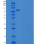 人PACSIN2/Syndapin-2重组蛋白C-6His