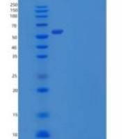 人PACSIN2/Syndapin-2重组蛋白C-6His