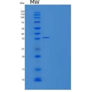人反式-2-烯酰辅酶a还原酶线粒体/MECR重组蛋白C-6H