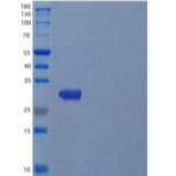 人类胰蛋白酶α/β-1/TPS ab 1重组蛋白C-6His