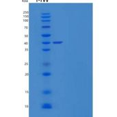 小鼠免疫球蛋白γ-1链C区/免疫球蛋白G1重组蛋白