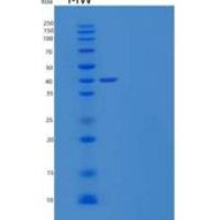 小鼠免疫球蛋白γ-1链C区/免疫球蛋白G1重组蛋白