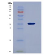 人唾液富组蛋白3(HTN3)重组蛋白