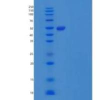 人胰脂肪酶相关蛋白1/PLRP1重组蛋白C-6His