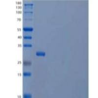 人3-羟基丁酸脱氢酶2型/BDH2/DHRS6重组蛋白N-6His