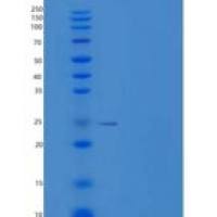人脱氧胸苷酸激酶(DTYMK)重组蛋白C-6His