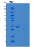 人突触小泡蛋白同源物YKT6/YKT6重组蛋白N-6His