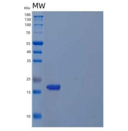 人细胞周期蛋白依赖激酶4抑制剂C/CDKN2C重组蛋白N-6