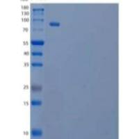 人磷脂酰肌醇4-激酶β/PI4KB重组蛋白C-6His