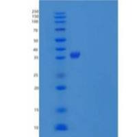 小鼠透明质酸结合蛋白2(HABP2)重组蛋白C-6His