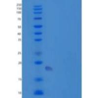 人TMIGD2/IGPR-1/CD28H重组蛋白C-6His