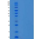人NIP7/KD93重组蛋白N-6His