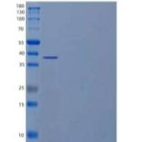 人抑制素βC(INHbC)重组蛋白C-6His