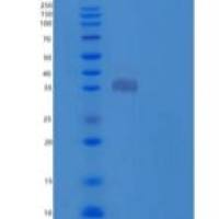 小鼠组织蛋白酶L(CTSL)重组蛋白