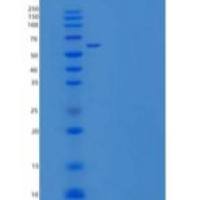 人结缔组织生长因子/CTGF/CCN2重组蛋白C-Fc