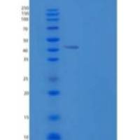 人OBFC1/CST复合亚单位STN1重组蛋白N-6His