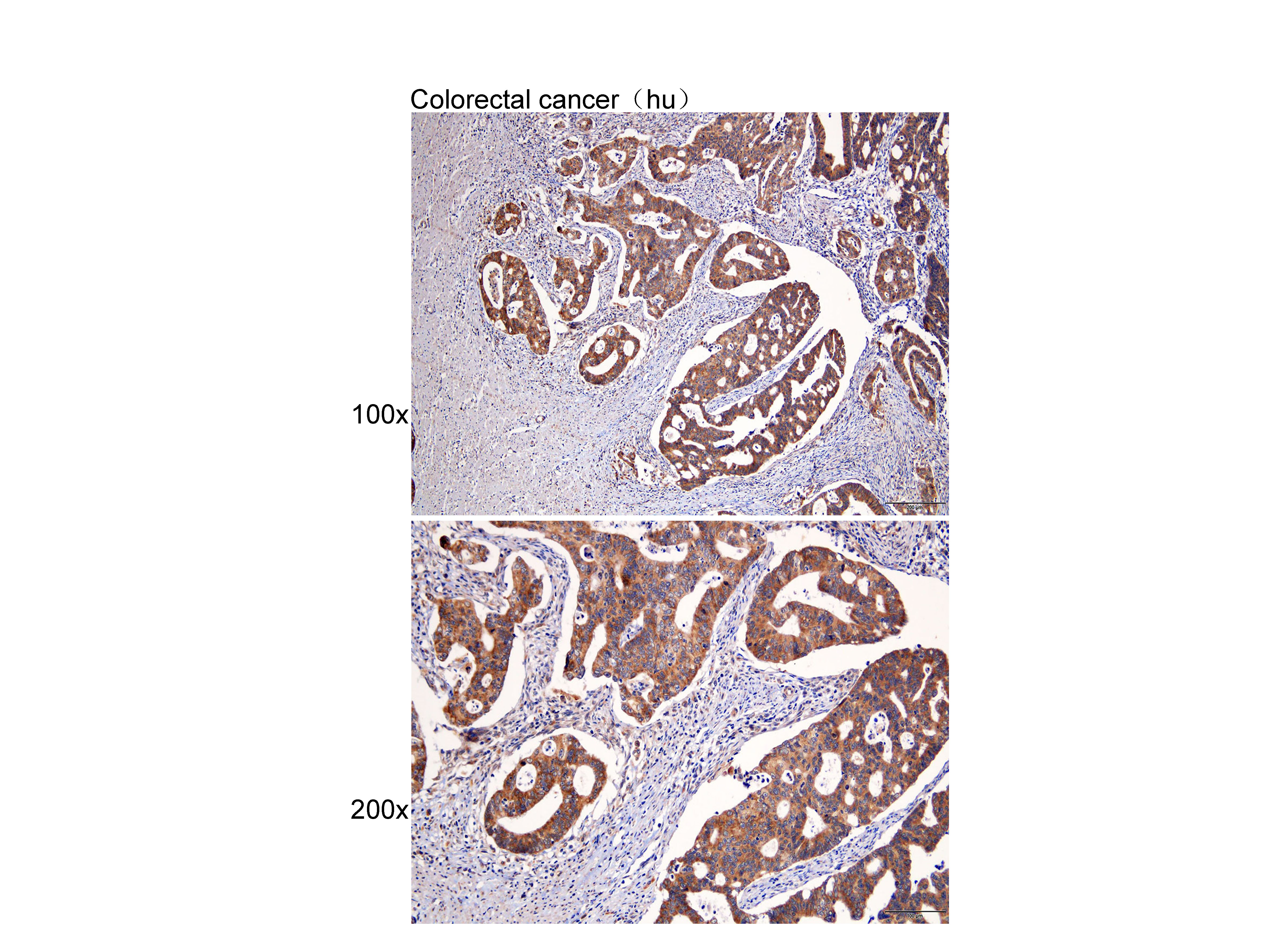 Anti-PAR4 Polyclonal Antibody