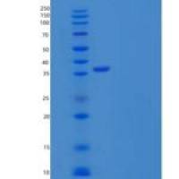 人转醛醇酶/半乳糖苷酶重组蛋白C-6His