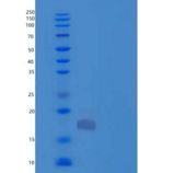人硫氧还蛋白结构域蛋白12/TXNDC12/ERp18重组蛋白C-6His