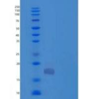 人硫氧还蛋白结构域蛋白12/TXNDC12/ERp18重组蛋白C-6His