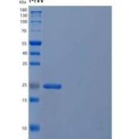 人5-甲酰四氢叶酸环化连接酶/MTHFS重组蛋白C-6His