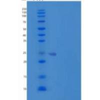 人海马钙蛋白样蛋白1/HPCAL1重组蛋白N-6His