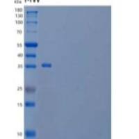 人亲环素E/蛋白酶E/PPIE重组蛋白N-6His