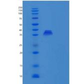 人PBLD/MAWBP重组蛋白N-6His
