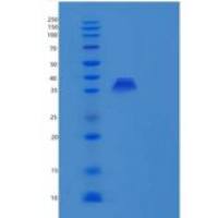 人PBLD/MAWBP重组蛋白N-6His