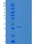 人PAPS合酶1/PAPSS1重组蛋白C-6His