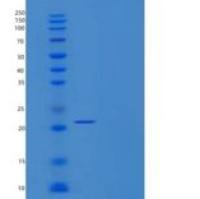 人PAPS合酶1/PAPSS1重组蛋白C-6His