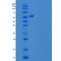 人PACSIN1/Syndapin-1重组蛋白C-6His