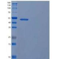 人磷脂酰肌醇5-磷酸4-激酶2α/PIP4K2A重组蛋白C-6His