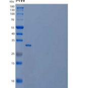 小鼠白介素12(IL12)重组蛋白