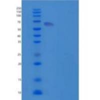 人组织型纤溶酶原激活剂/平台重组蛋白C-6His