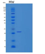 人PAPS合酶1/PAPSS1重组蛋白C-6His