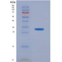 人胰岛素样生长因子2-mRNA结合蛋白2(IGF2BP2)重组蛋白