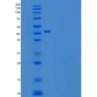 人IgG1 Fc/IGHG1重组蛋白