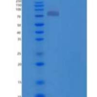 人Thimet脱寡肽酶1(THOP1)重组蛋白C-6His