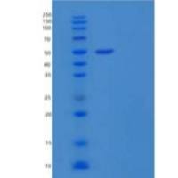 人IL-2受体亚单位β/IL-2RB/CD122重组蛋白C-Fc