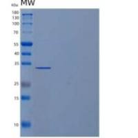 人肌醇单磷酸酶2重组蛋白