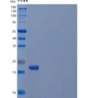 人肌苷三磷酸焦磷酸酶/ITP酶重组蛋白C-6His