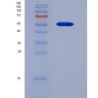 人色氨酸- tRNA连接酶,细胞质/WARS/TrpRS重组蛋白N-6His